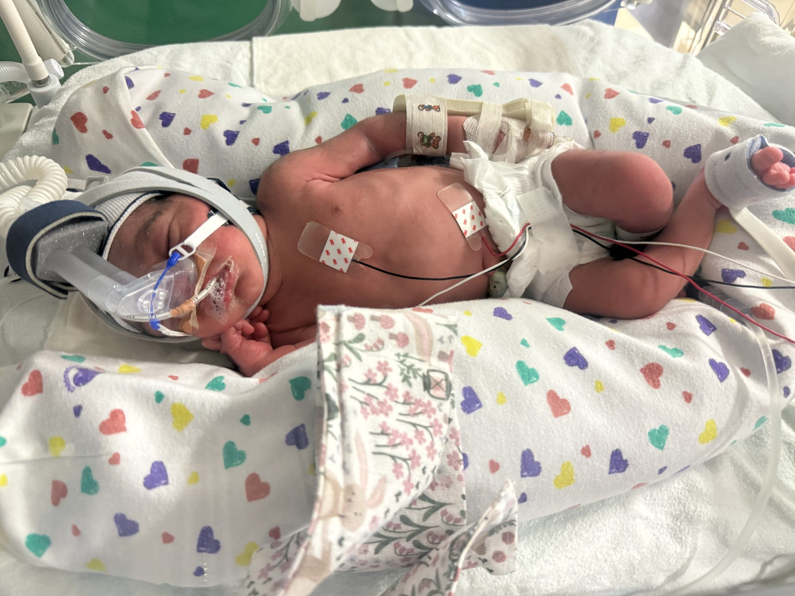 Manvi’s urgent flight to NICU